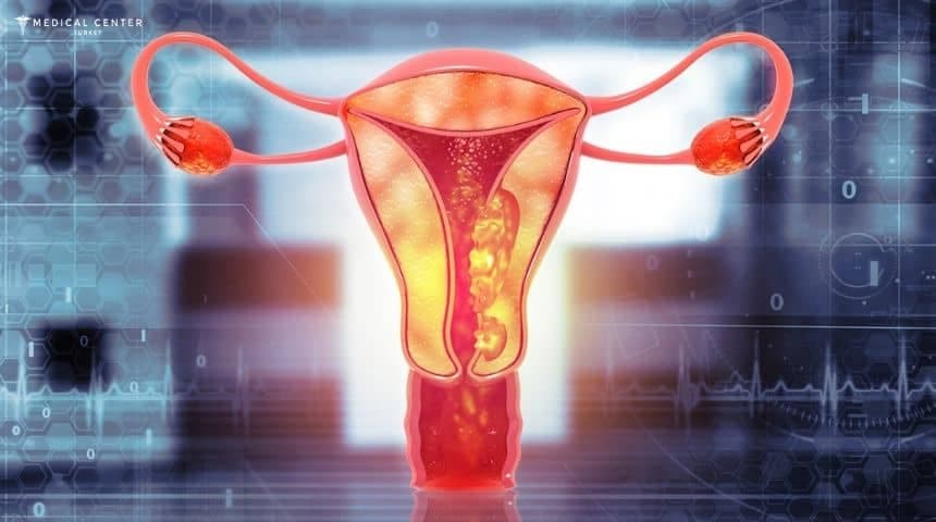 Uterine Cancer in Turkey