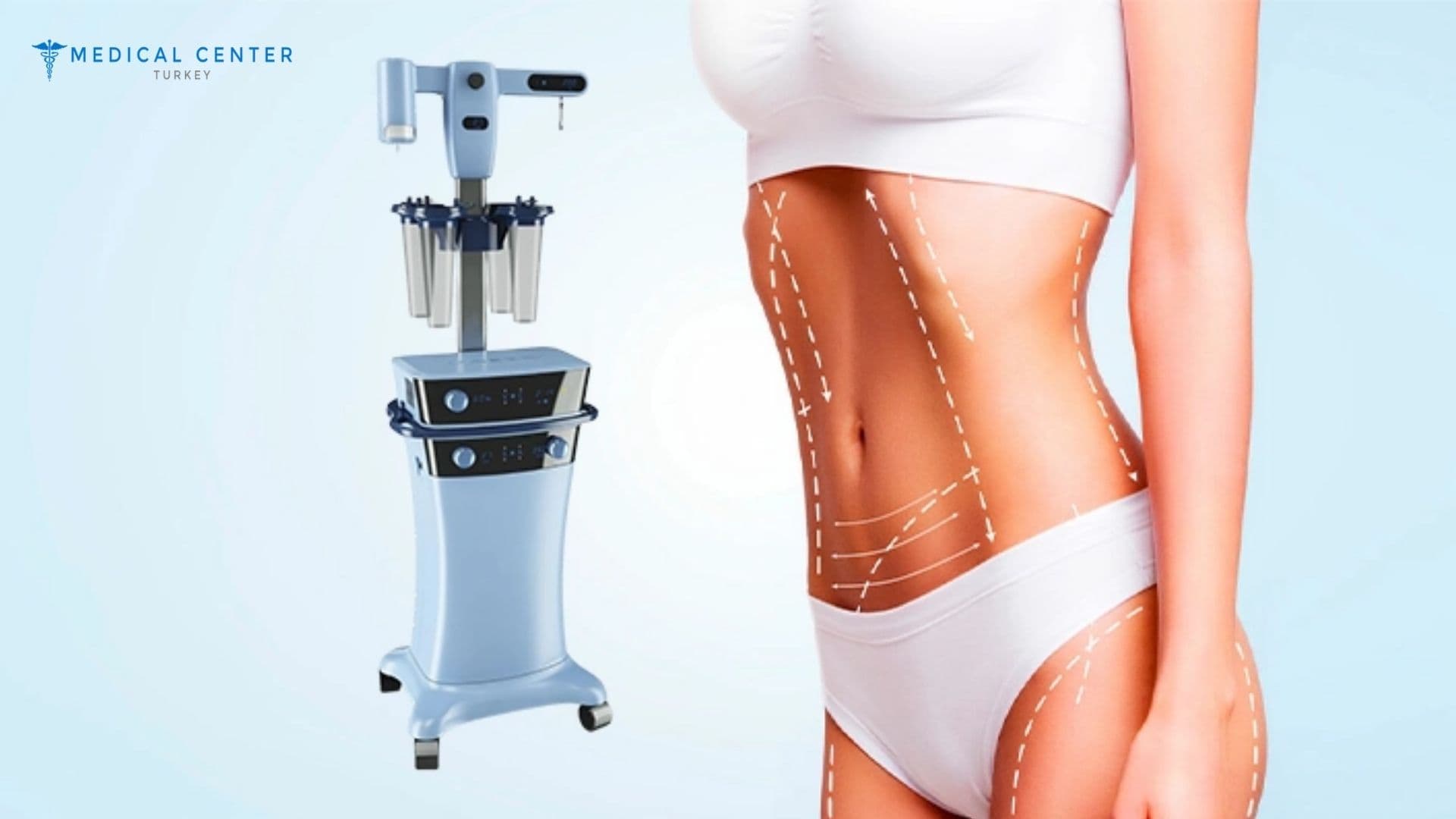 Vaser Liposuction Turkey Before and After