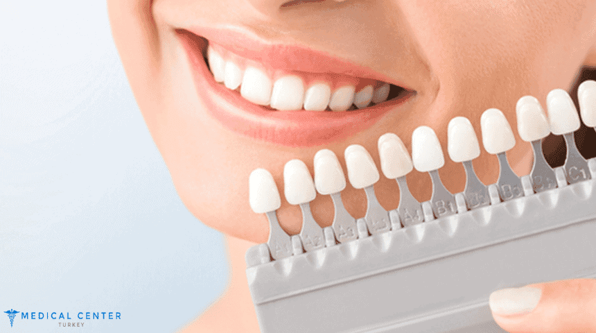 Veneers Cost in Turkey