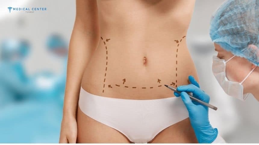 What Are the Risks Involved in Liposuction?