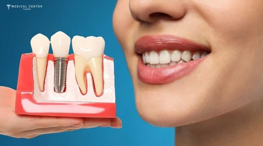Which Dental Implant Option Is Best for You?