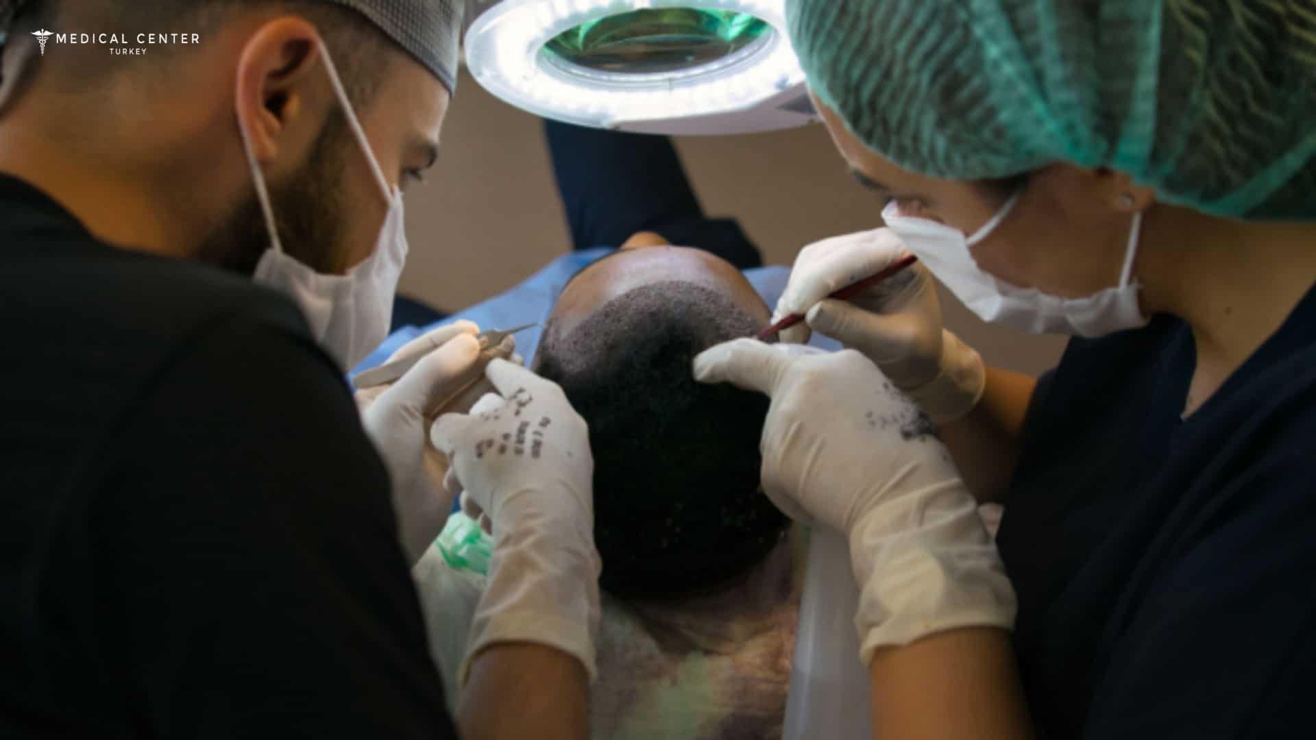 Which Hair Transplant Technique Works Best in 2026?