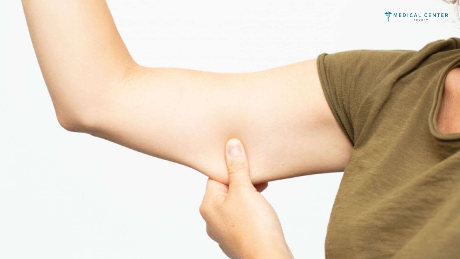 Why Is Turkey the Best Place to Get a Mini Arm Lift?
