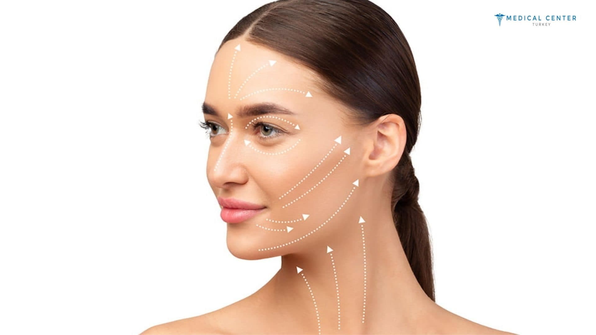Why Deep Plane Facelifts are Trending?