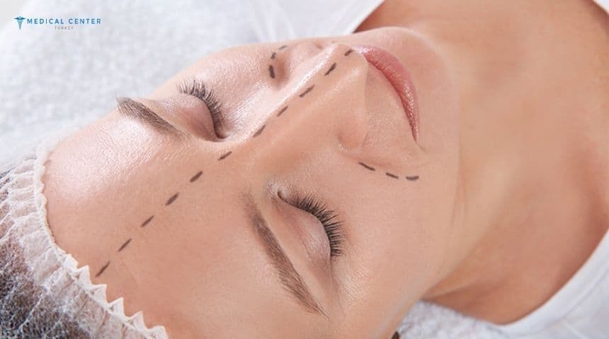 Why Is Preservation Rhinoplasty So Popular?