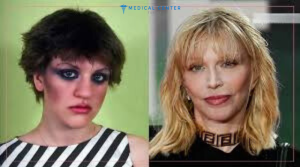 10 Celebrity Rhinoplasty Results