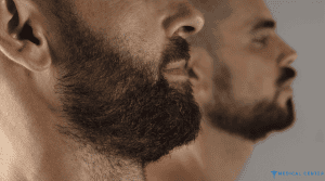 Beard Transplant Cost Turkey 