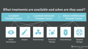 Brachytherapy for Prostate Cancer