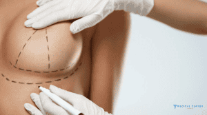 Breast Augmentation Understanding Different Implant Options