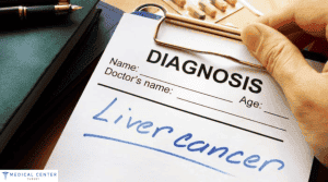 Can stage 4 liver cancer be cured?