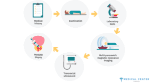 CHEMOTHERAPY FOR PROSTATE CANCER