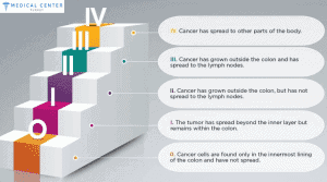 Colon Cancer Treatment in Turkey