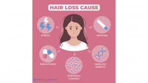 hair transplant