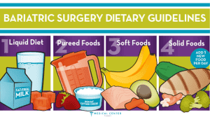 Frequently Asked Questions About Gastric Bypass Surgery 3
