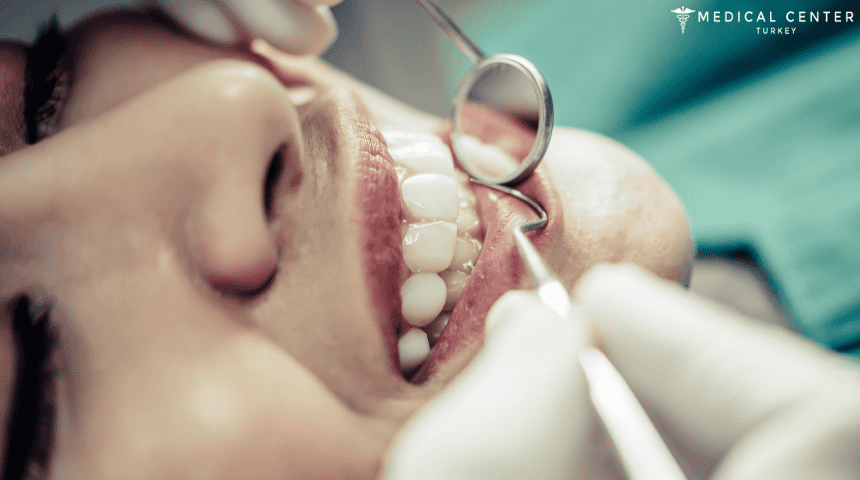 Gum Surgery in Turkey