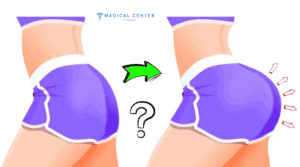 How to Make the Butt Bigger (3)