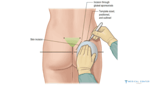 How to Make the Butt Bigger (4)