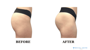 How to Make the Butt Bigger (5)