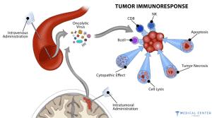Immunotherapy in Turkey