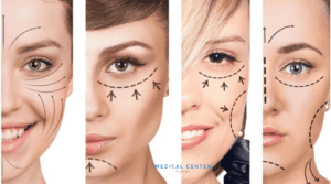 Is Facelift Painful?