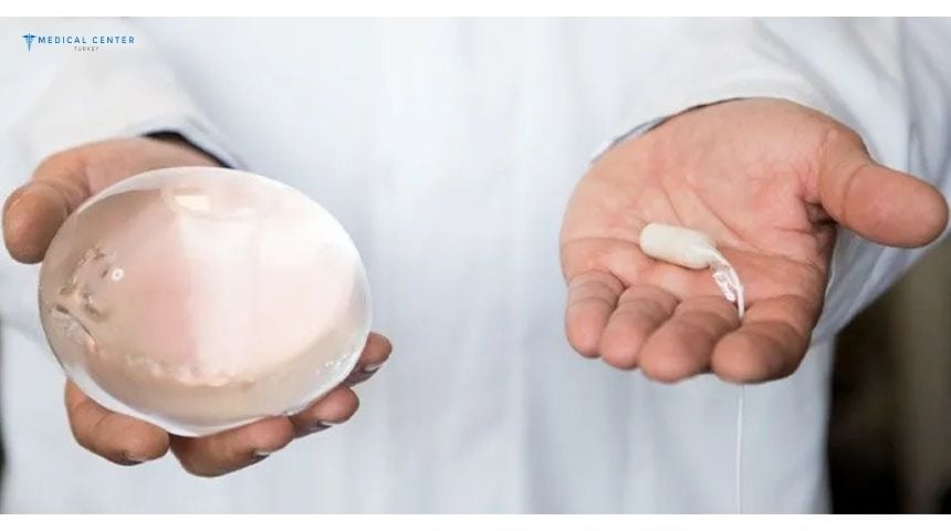 Is the Gastric Balloon Right for You?