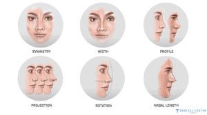 Rhinoplasty in Turkey: Types, Prices, Procedures