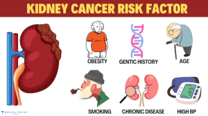 risk factors of kidney (renal) cancer