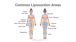 liposuction costs in Turkey 2