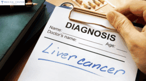 LIVER CANCER STAGE 3