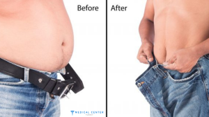 Medical Tourism: Weight Loss Surgery Abroad?