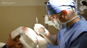 Micheal’s Hair Transplant Experiences in Turkey