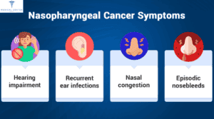 Nasopharyngeal Cancer
