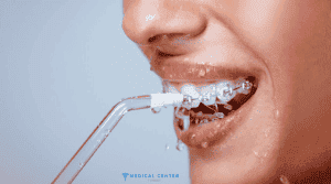 Orthodontic Treatments in Turkey