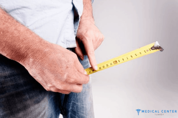 penis_enlargement