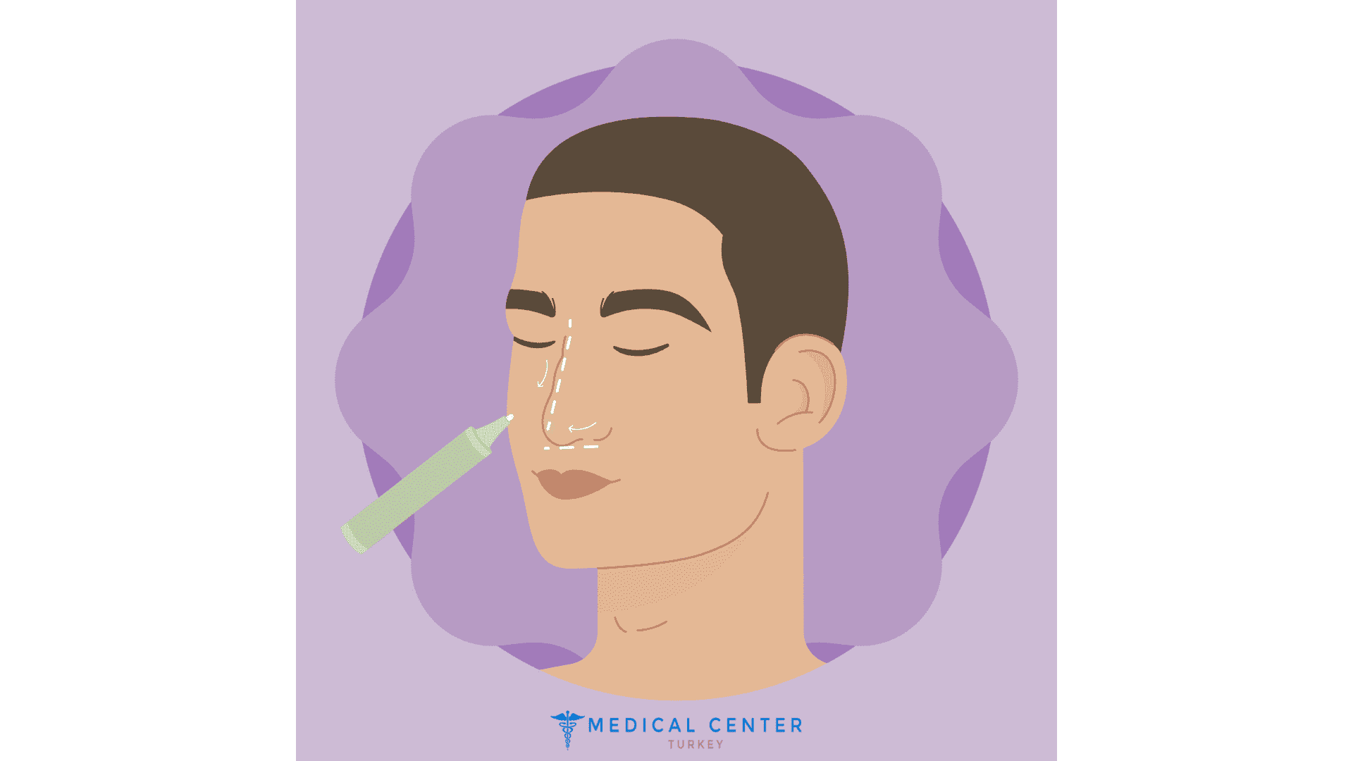 Plastic Surgery for Men Trends And Procedures