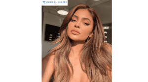 The Secret of Kylie Jenner's Lips
