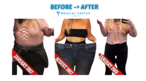 the best and cheapest weight loss surgery by country