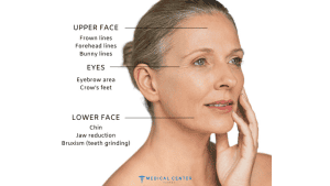 The Latest Advances in Anti-Wrinkle Injections in Turkey 2025