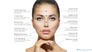 The Latest Advances in Anti-Wrinkle Injections in Turkey 2025 6