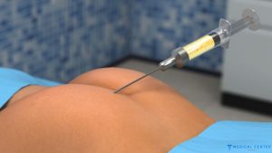 The Role of Fat Transfer in Modern Cosmetic Surgery