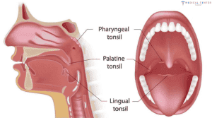 Tonsil Cancer