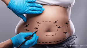 TOP 10 TREATMENTS THAT PEOPLE TRAVEL FOR 