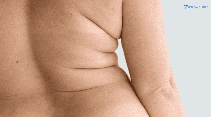Top Five Countries for Weight Loss Surgery