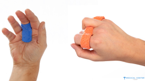 Trigger Finger Correction in Turkey 2025