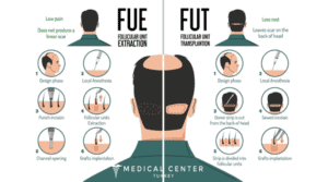 What are the treatment options for baldness