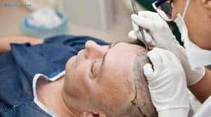 What is New in Hair Transplants in 2026?