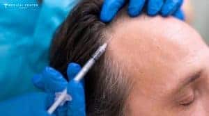What is New in Hair Transplants in 2026?