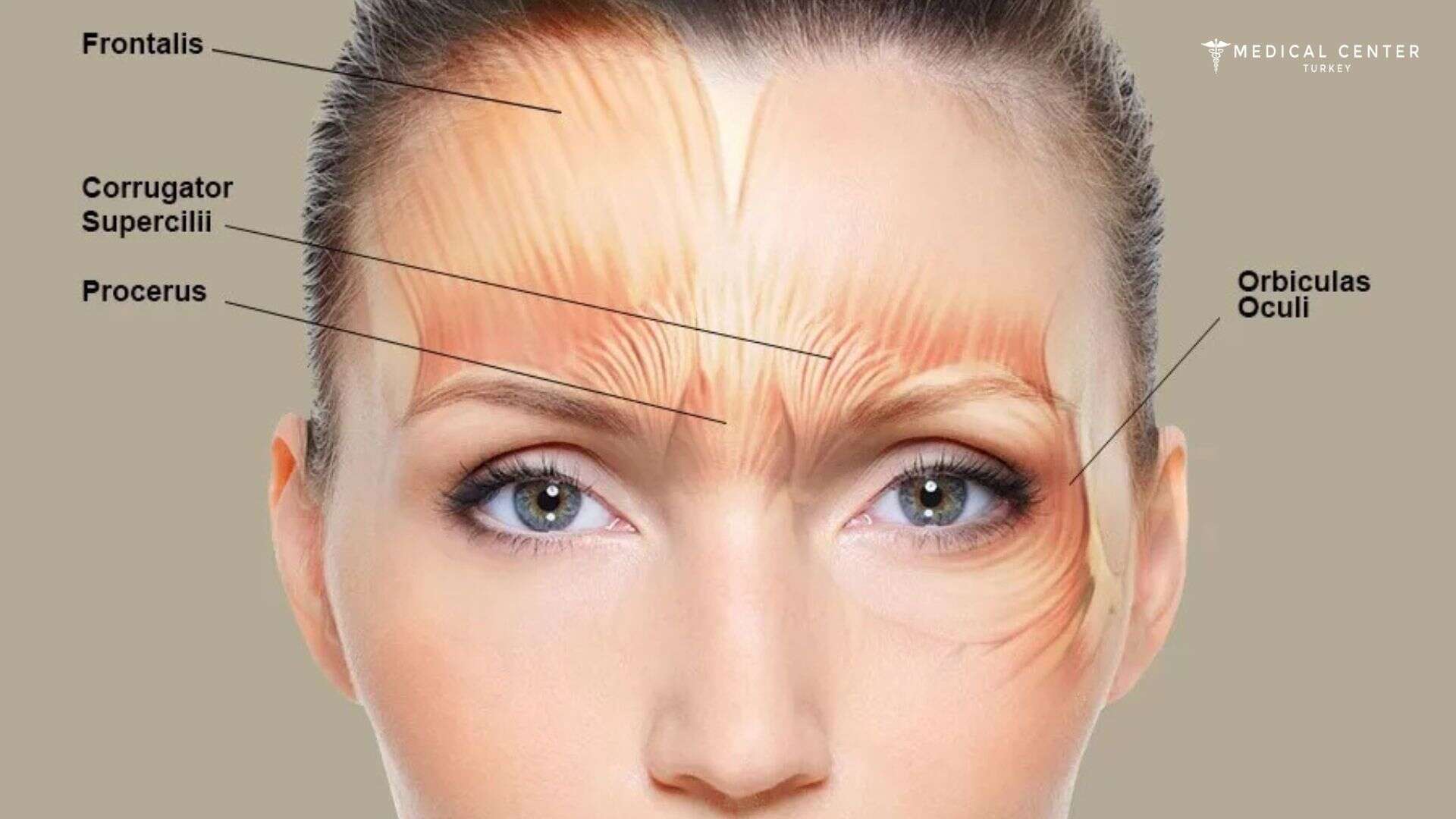 What Results Can Be Expected From Botox?