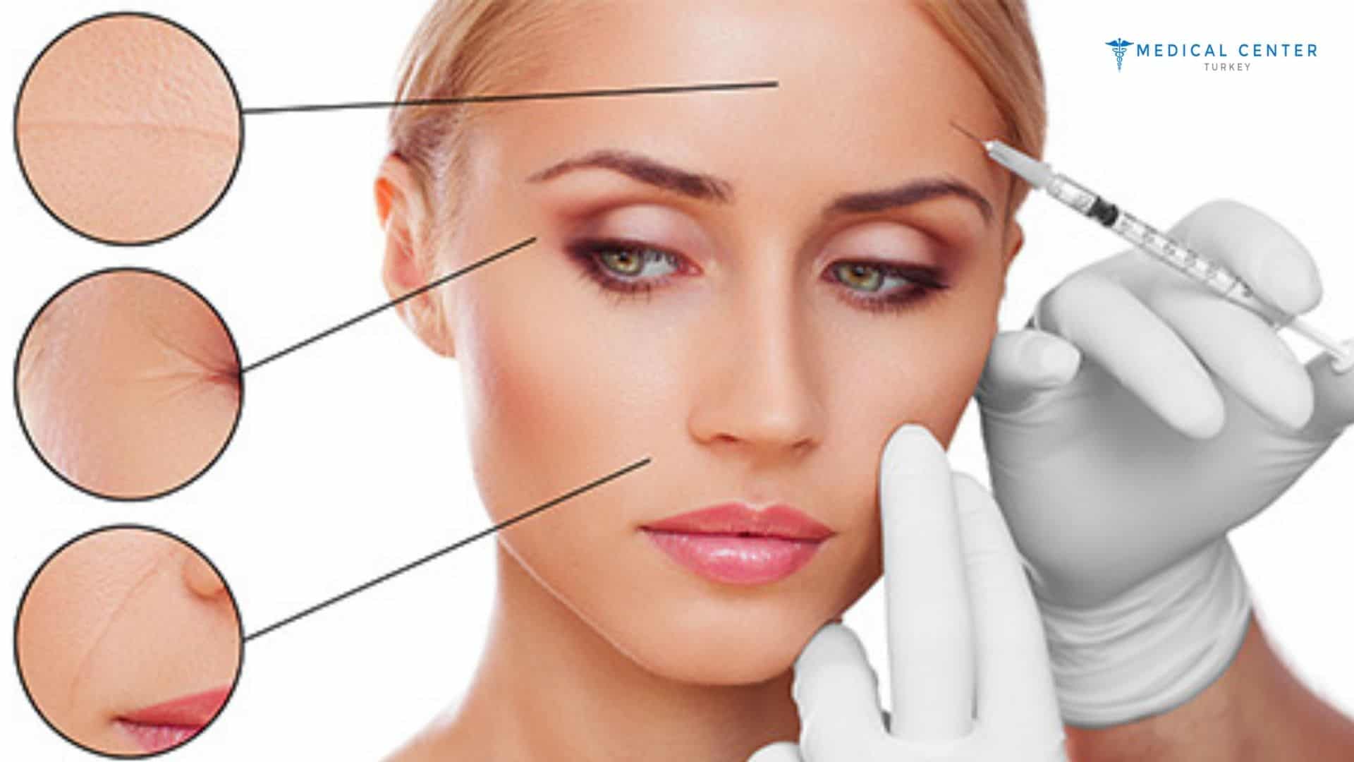 What Results Can Be Expected From Botox?