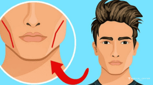 What to Expect From Jawline in Turkey